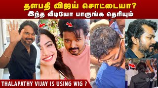 விஜய் சொட்டையா Vijay is using WIG | Thalapathy Vijay Bald Head | Vijay Hairstyle | Tamil Bald Actors