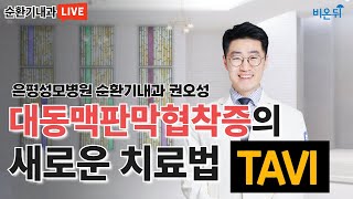 대동맥판막협착증의 새로운 치료법(TAVI) (은평성모병원 순환기내과 권오성)