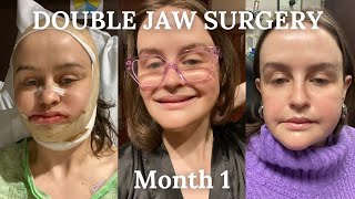 Month 1 | Double Jaw Surgery Journey
