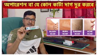 Mederma Advanced Scar Removal Gel | সার্জারির দাগ দ্রুতগতিতে দূর করে যে ক্রিম | Scar Removal Cream