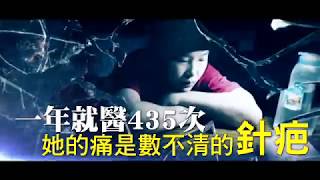 【獨家專訪】1年看病435次　她的痛是數不清的針疤 | 微視蘋 | 台灣蘋果日報