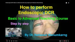 Endoscopic DCR:  Basic to Advanced with every steps by Dr  Nattawut Wanumkarng