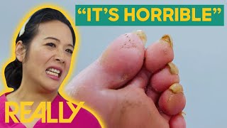 Marion Assists a Patient with Severely Odorous Feet | The Bad Foot Clinic | Bran