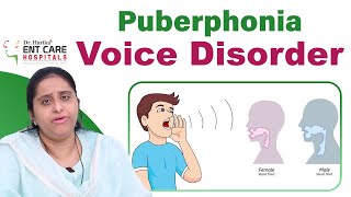 What is Puberphonia \u0026 Causes || Voice Disorder || Change of Voice || Dr Harika ENT Care Hospital