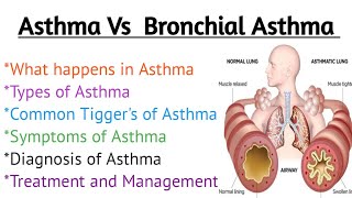 Asthma,Bronchial Asthma |Types|causes|Treatment|Pathophysiology| Hindi\\urdu #mlt