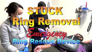 STUCK Ring Removal Emergency