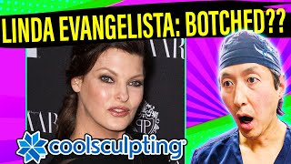 How to Avoid Linda Evangelista's CoolSculpting DISASTER! A Plastic Surgeon Explains