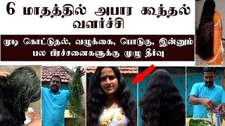 6 மாதத்தில் அபார கூந்தல் வளர்ச்சி, முடி கொட்டுதல் ,வழுக்கை,பொடுகு பல பிரச்சனைகளுக்கு முழு தீர்வு