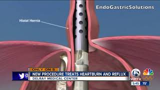 New procedure treats heartburn and reflux