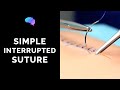 Simple interrupted suture (wound suturing) - OSCE Guide | UKMLA | CPSA | PLAB 2