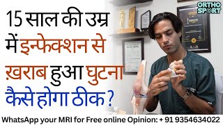 इन्फेक्शन से ख़राब हुआ घुटना कैसे होगा ठीक ? How to Treat Early-Age Knee Arthritis by Infection