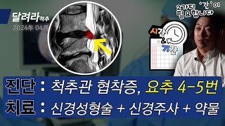 척추 시술도 시간과 기간이 필요하다!