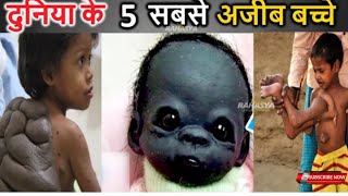 😲दुनिया के 5 सबसे अजीब बच्चे facts about children