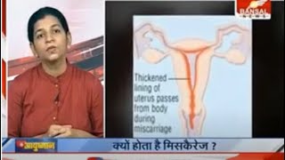 Miscarriage जानिए गर्भपात के कारण लक्षण \u0026 इलाज |अगली प्रेगनेंसी में गर्भपात से बचने के लिए  क्या करे