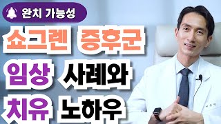 쇼그렌증후군 완치 사례, 쇼그렌증후군 치료 사례에 대하여