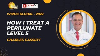 Wiroc Global 2022 : How I treat a Perilunate Level 5 - Charles Cassidy