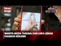 Selebgram Asal Sidoarjo Dianiaya Kekasih