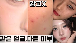 광고❌나는 왜 피부가 안 좋을까?고민하지 말고 클릭❗피부관리 꿀팁\u0026꿀템 대공개(+요철,좁쌀,모공 등 피부 고민이제 그만..❗️