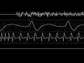 David Whittaker - “Army Moves (Amiga) - In-Game Theme” [Oscilloscope View]