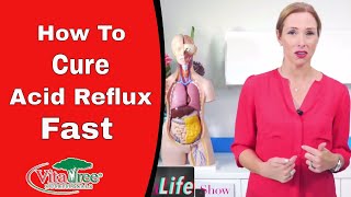 How To Help Acid Reflux Fast : Heartburn Remedy - VitaLife Show Episode 272