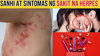 Alamin ang mga Sanhi at Sintomas ng Herpes o HPV