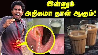 Stomach Ulcer: வயிற்றில் எரிச்சல் இருக்கா  இனிமே இத பண்ணுங்க🤩