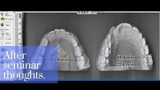 After Seminar notes and Model analysis  - Orthodontic Matters Episode 19