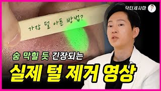 남자수염레이저제모는 이렇게 해야 정답입니다!