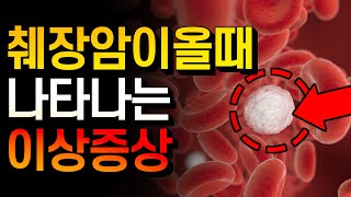 입 속에  '이 것'  췌장암 신호입니다! 아무도 몰랐던 췌장암 증상! 이런 증상 있으면 꼭 검사해보세요!