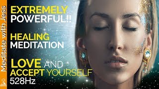 Extremely Powerful Guided Meditation.  Experience Deep Love And Acceptance For Yourself.  Healing.