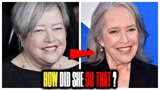 Kathy Bates' SHOCKING TRANSFORMATION: Hollywood Stunned!