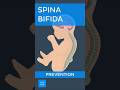 Spina bifida: Prevention | Kenhub #spinabifida