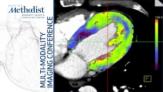 CTA for Assessment of Coronary Anatomy and Physiology (Su-Min Chang, MD) December 7, 2021