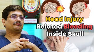 Head Injury Related Bleeding Inside Skull| Dr.Roopesh Kumar