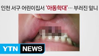 어린이집 아동학대 또...앞니 두개 부러져 / YTN