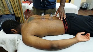 The Beginner’s Guide to Advanced Cupping Techniques