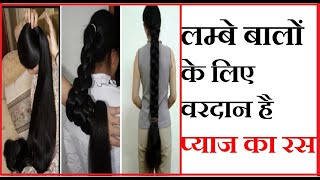 प्याज से बालों को लम्बा घना बनाये, Onion (Pyaj) Benefits For Hair