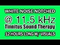 White Noise - Notch Filtered at 11.5 kHz for Tinnitus Therapy w/ VIsuals