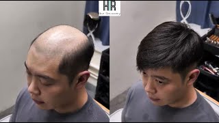 【Hair Recovery復原法】香港假髮專門店 -簡單自然風格! (精華版)