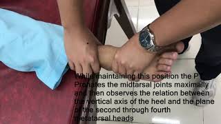 Forefoot-Heel Alignment Test