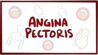 Angina pectoris (stable, unstable, prinzmetal, vasospastic) - symptoms & pathology