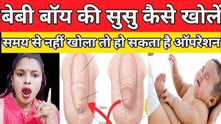 how to open baby boy private part.बेबी बॉय की सुसु कैसे खोलें।