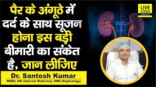 Dr. Santosh Kumar से जानें, किस तरह पैर के अंगूठे का दर्द और सूजन बनते हैं बड़ी बीमारी का कारण,सुनिए