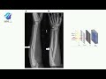 radiographic testing in hindi rt testing in ndt non destructive testing radiographic testing ndt