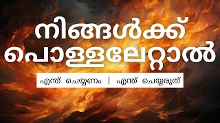 പൊള്ളലേറ്റാൽ എന്തുചെയ്യണം! |FIRST AID |Burns-സാധാരണയായി ചെയ്യുന്ന തെറ്റുകൾ-malayalam,(pollal ettal)