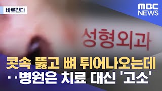 [바로간다] 콧속 뚫고 뼈 튀어나오는데‥병원은 치료 대신 '고소' (2022.06.10/뉴스데스크/MBC)