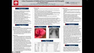 FLACP - A Rare Presentation of Childhood Onset Granulomatosis with Polyangiitis as a Palatal Defect