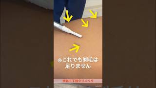 【医療脱毛】施術前の剃毛ってどれくらいがんばればいい？【みんなの疑問】