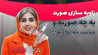 زاویه سازی فک و صورت چیست ؟ | بهترین روش زاویه سازی کدام است؟ | مدویکا