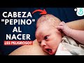 🤕👶🏻CABEZA APEPINADA del RECIÉN NACIDO en el PARTO *CAPUT VS CEFALOHEMATOMA* || Baby Suite by Pau